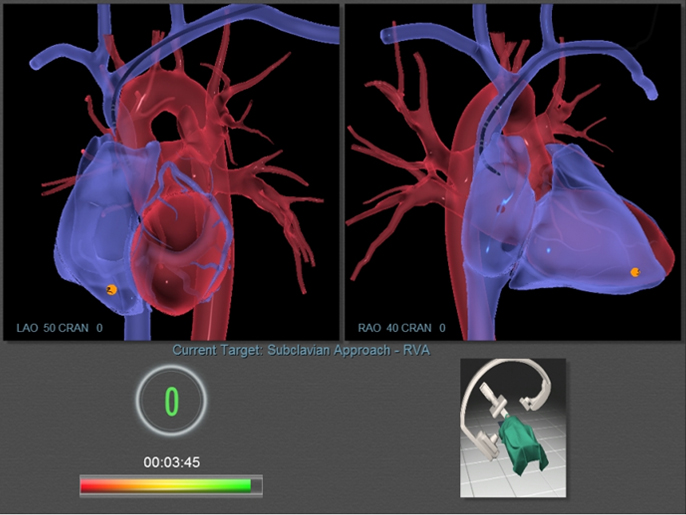 3D Model of the Heart