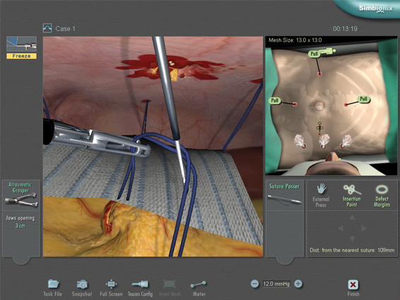 Simulation of the Surgical Environment