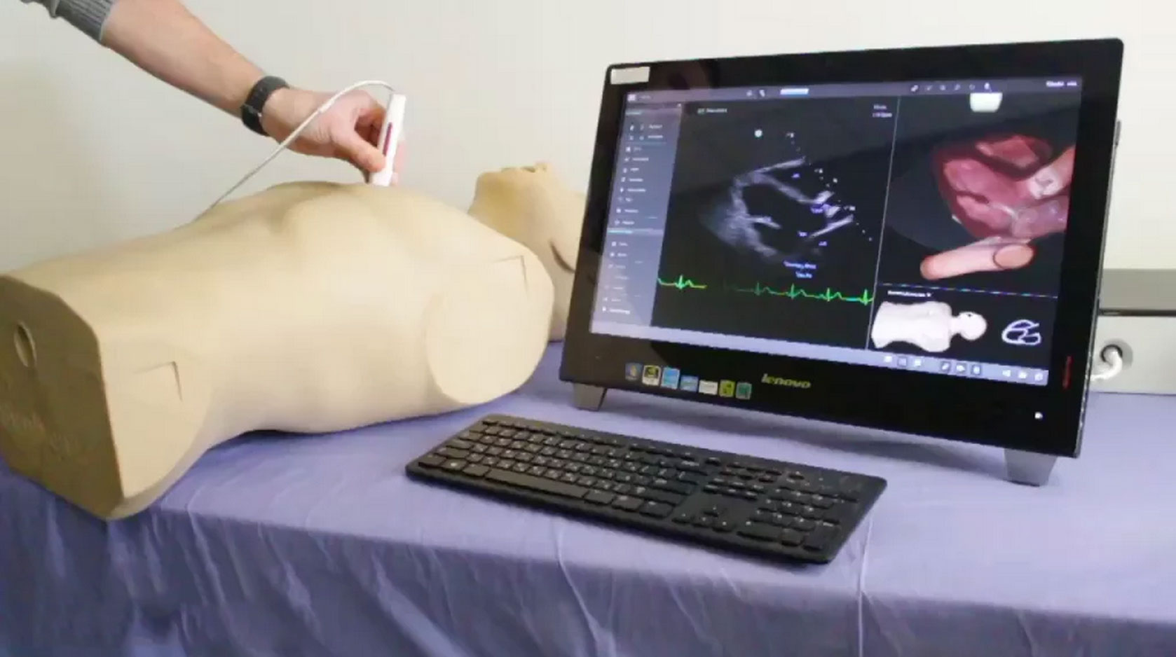Video – Bedside Echocardiography