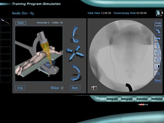 Full Simulation of the Fluoroscopic Procedure