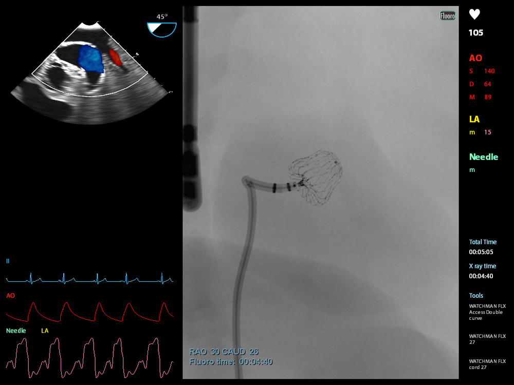 Doppler Echocardiography
